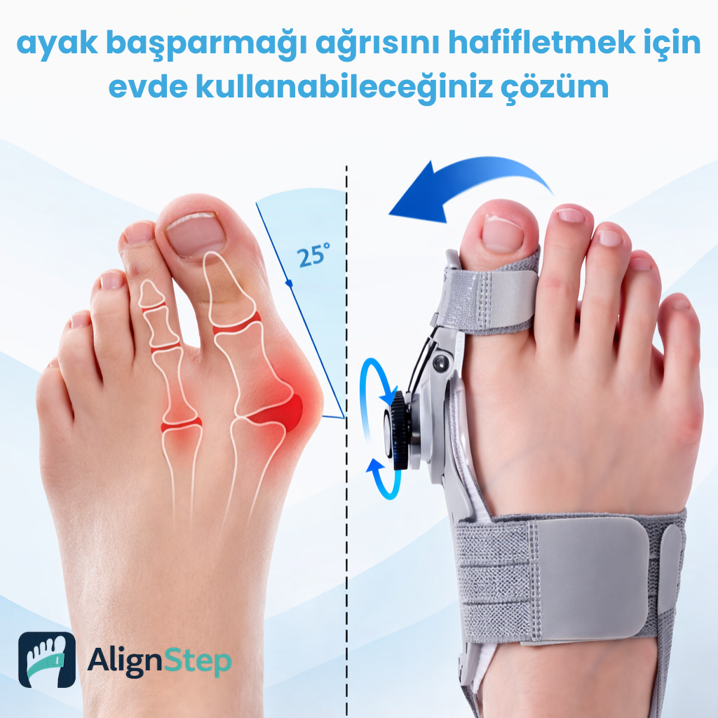 AlignStep™ Bunion Splint – Ayarlanabilir Başparmak Destek Ateli