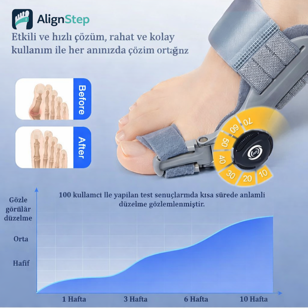 AlignStep™ Bunion Splint – Ayarlanabilir Başparmak Destek Ateli